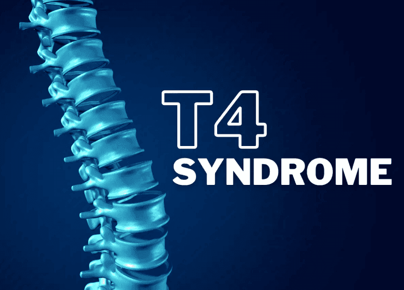 T4 Syndrome Case Study (Abstract)